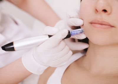 Mesotherapie / Microneedling Mesotherapie / Microneedling
